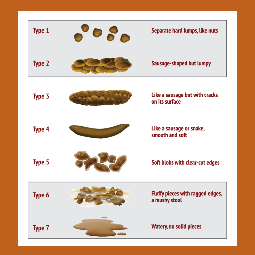 constipation, gut health, functional medicine, root-cause solutions, SIBO, dysbiosis, stool patterns, Bristol Stool Chart, digestive health, transit time